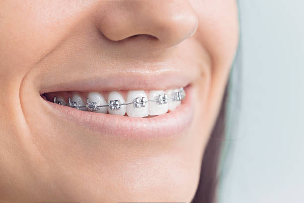 Best Veneers and Lumineers  in New Brockton, AL